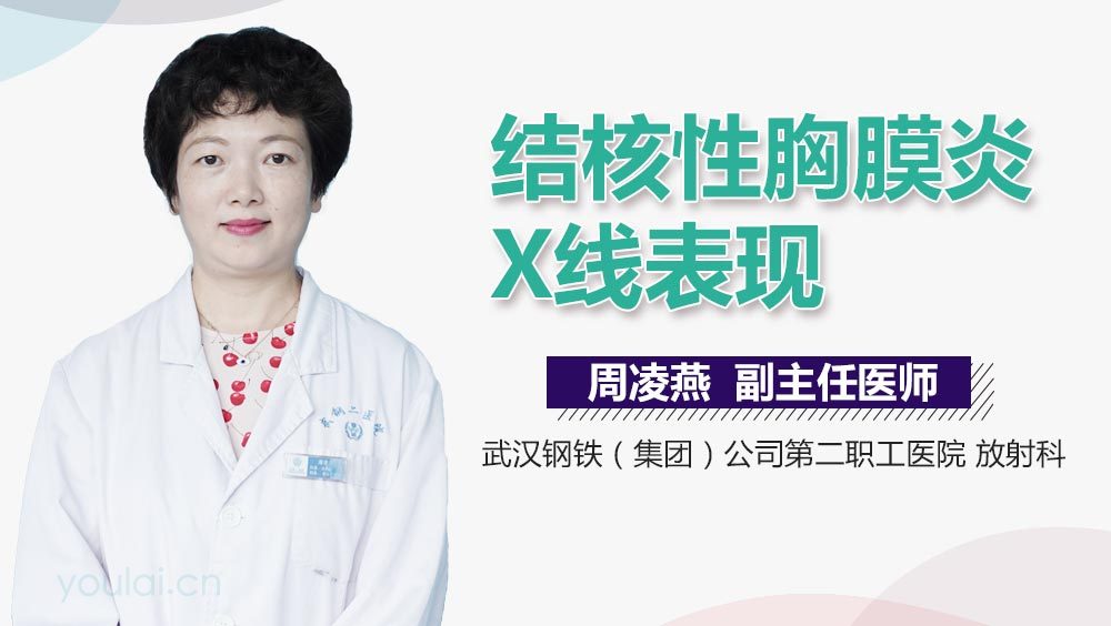 结核性胸膜炎X线表现