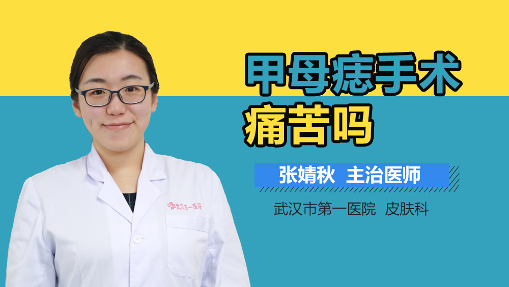 甲母痣手术痛苦吗