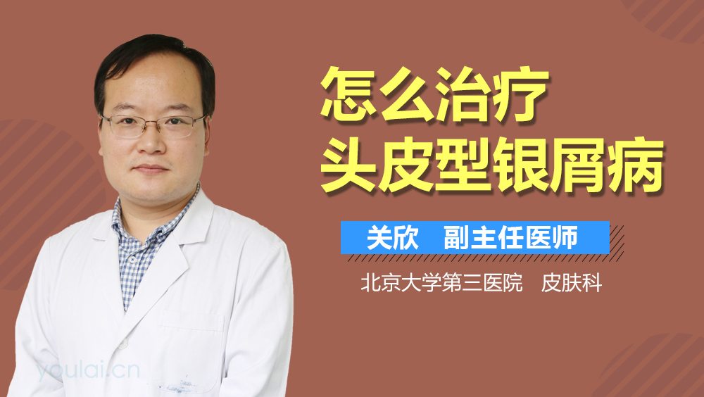 怎么治疗头皮型银屑病