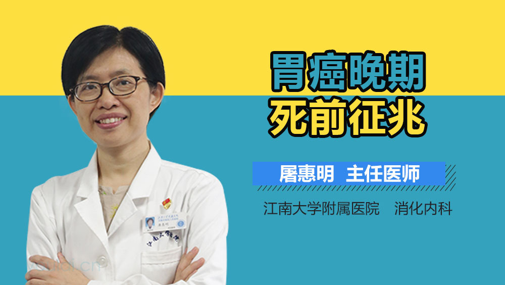 胃癌晚期死前征兆