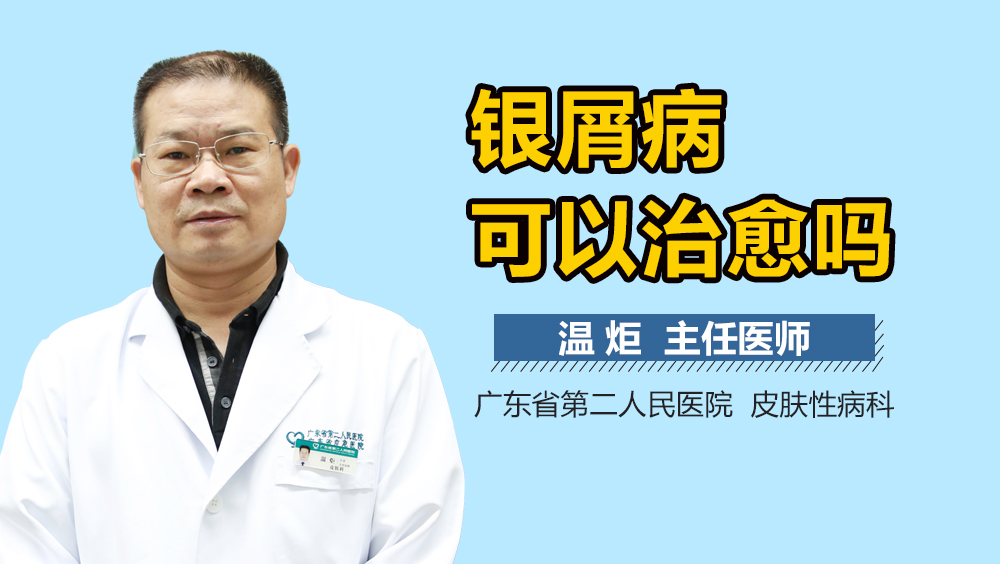 银屑病可以治愈吗