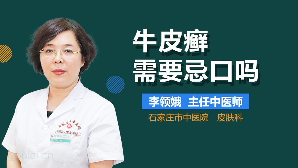 牛皮癣需要忌口吗