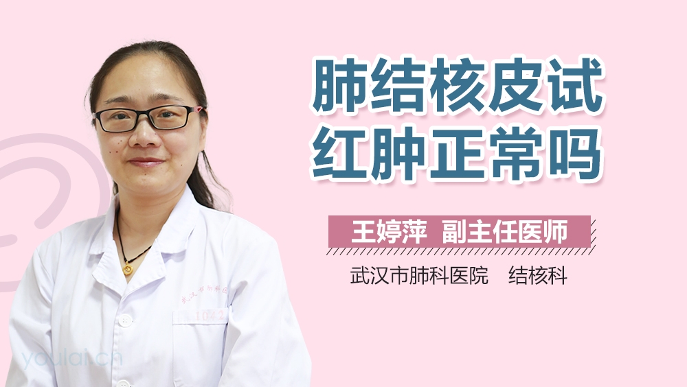 肺结核皮试红肿正常吗