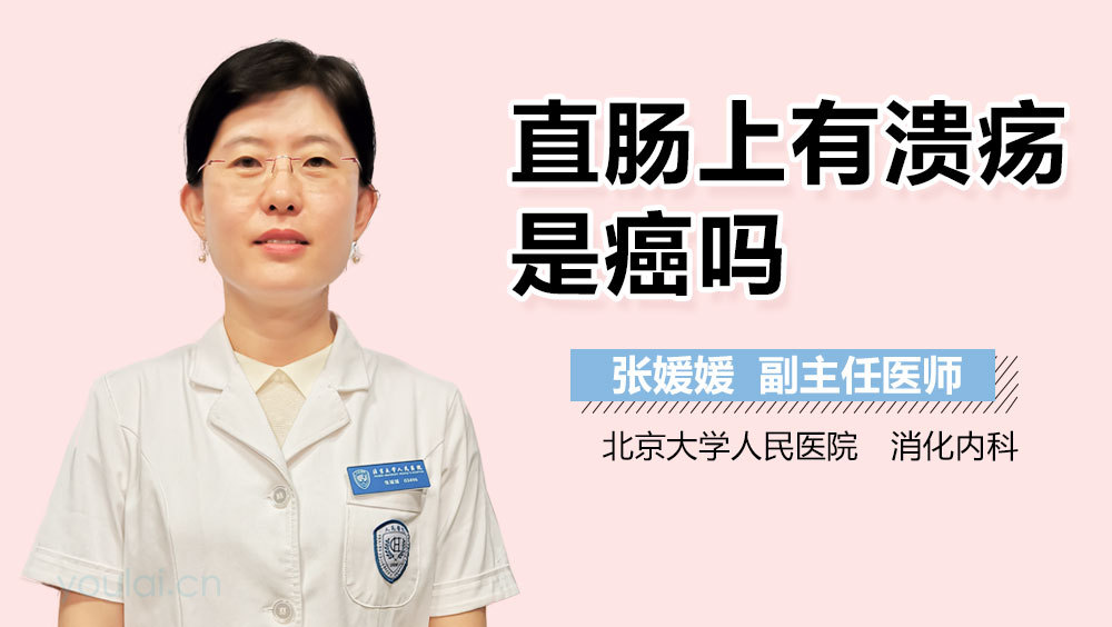 直肠上有溃疡是癌吗