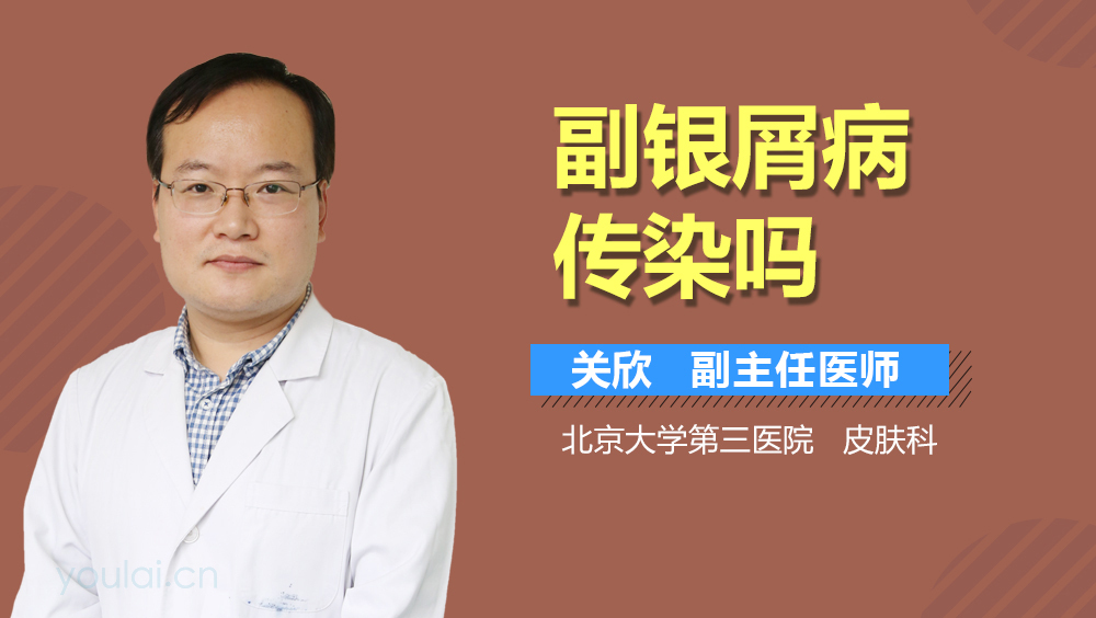 副银屑病传染吗