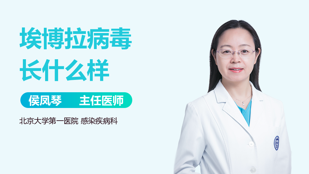 埃博拉病毒长什么样