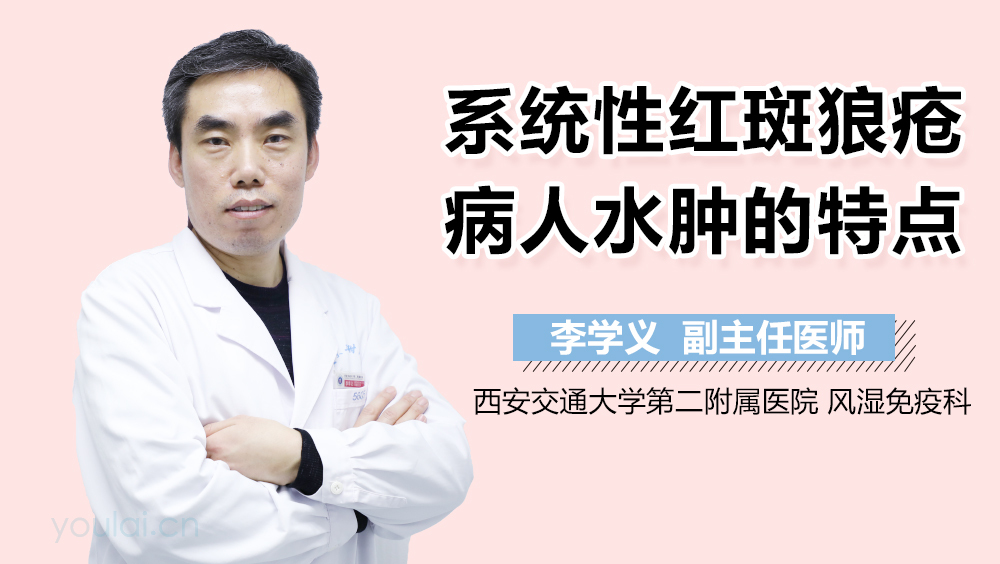 系统性红斑狼疮病人水肿的特点