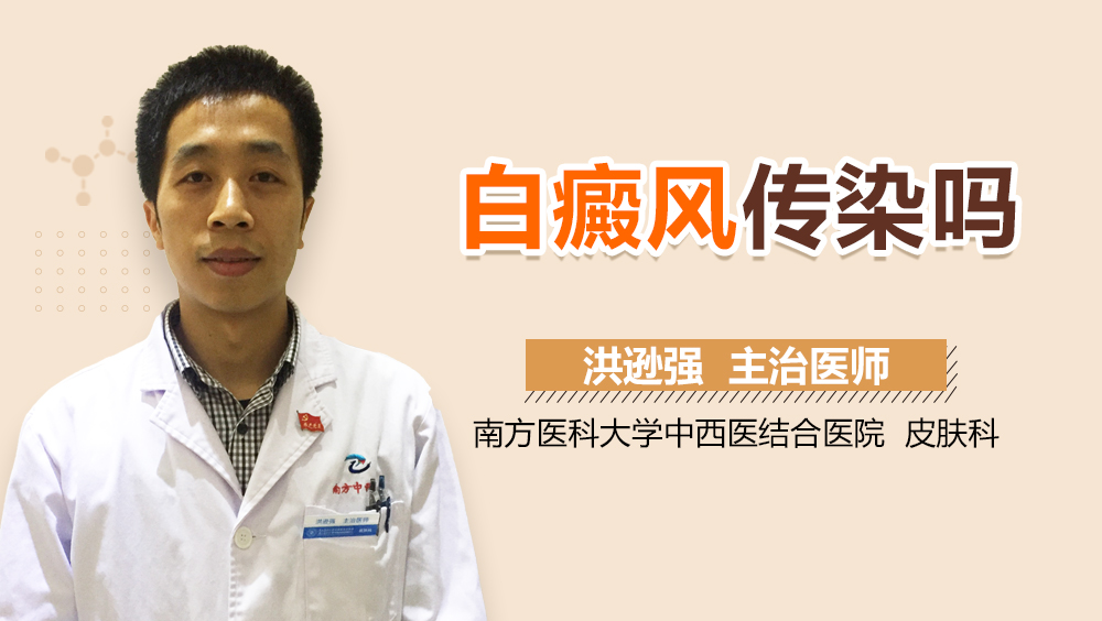 白癜风传染吗