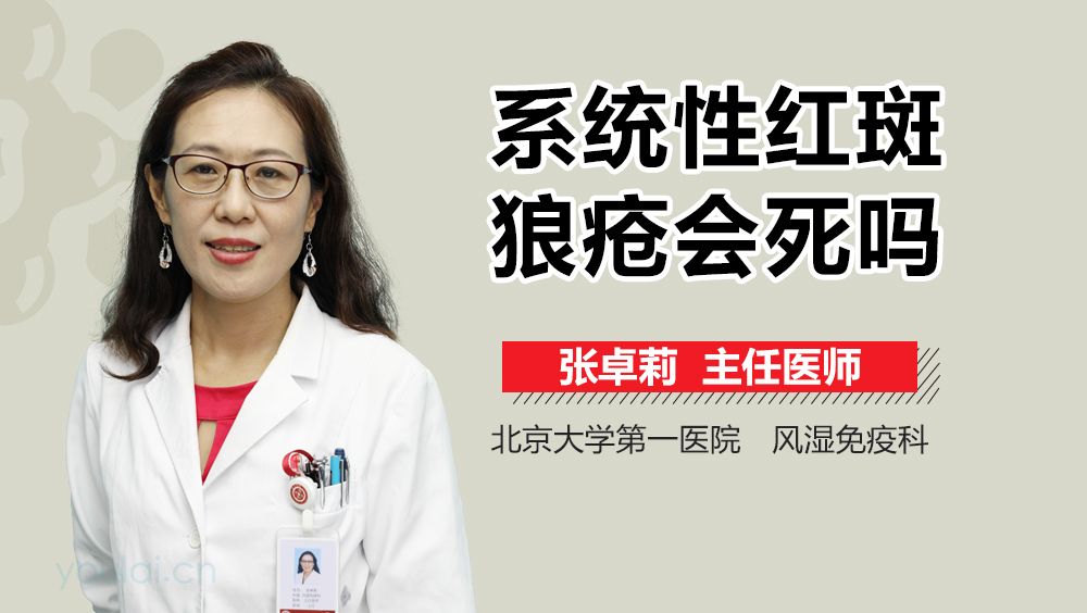 系统性红斑狼疮会死吗